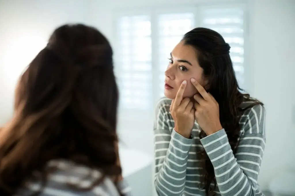 7 Proven Overnight Acne Treatment Methods