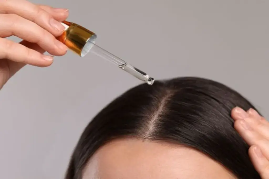 Hair Fall and Regrowth: Amazing Success 2 Understanding Hair Thinning: Causes and Prevalence