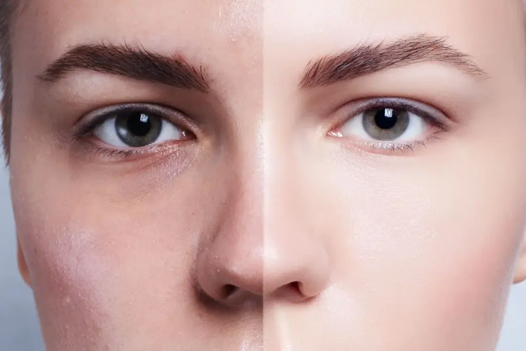 Understanding the Science Behind Clear, Healthy Skin