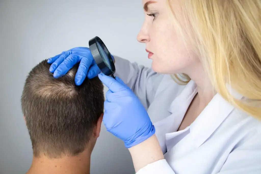 Male Or Female Pattern Baldness: Quick Fix 2 Understanding Pattern Baldness