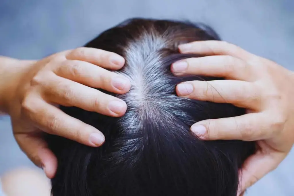 Male Or Female Pattern Baldness: Quick Fix 3 Male Pattern Baldness: Causes and Progression