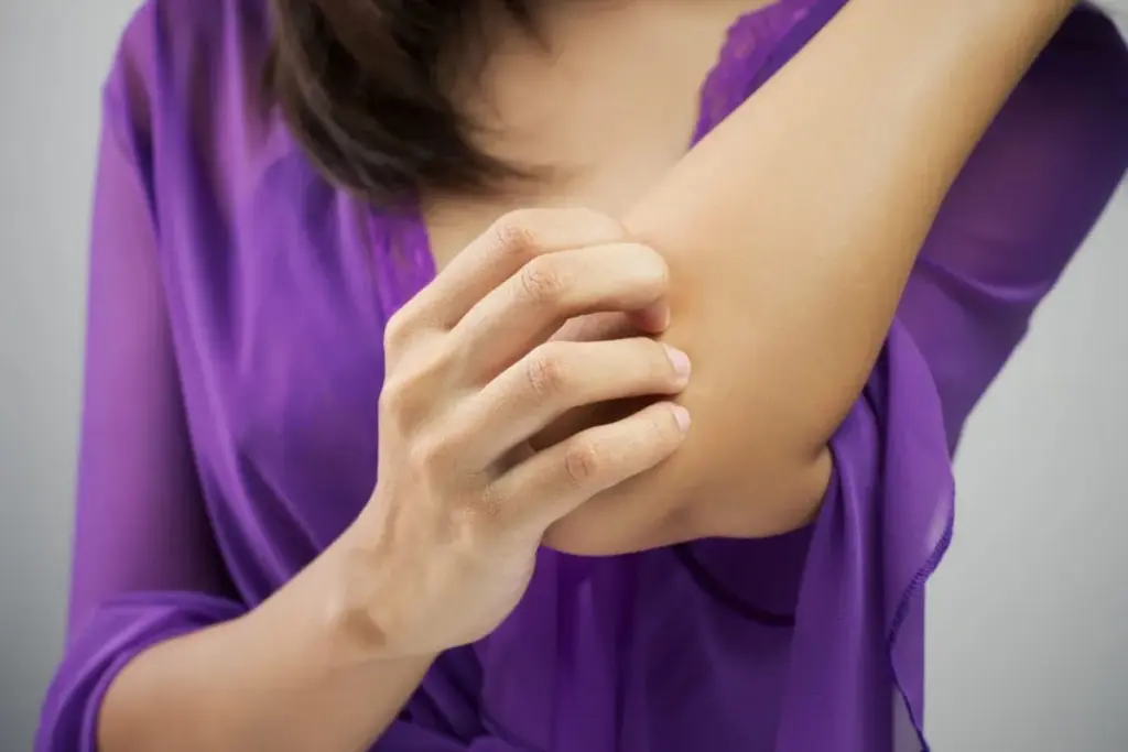 How to Stop Itchy Skin: Fast Home Remedies 1 How to Stop Itchy Skin: Fast Home Remedies