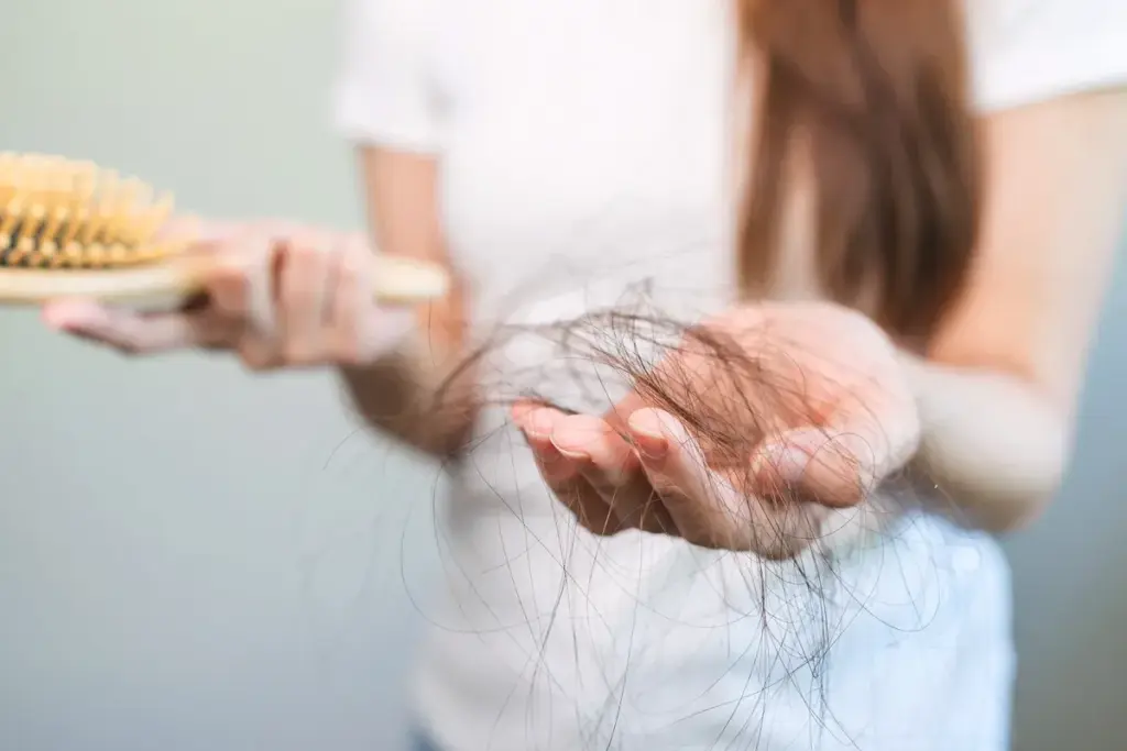 7 Effective PCOS Hair Loss Treatment Options
