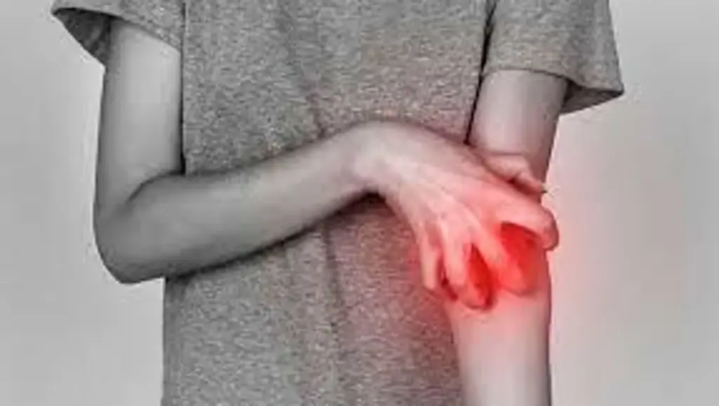 Seborrheic Dermatitis: Easy Stress Relief Tips