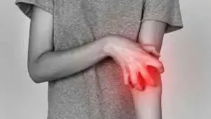 Seborrheic Dermatitis: Easy Stress Relief Tips