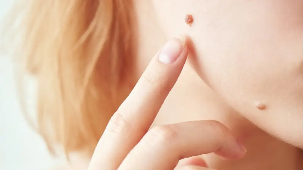 Mole Checker App: Powerful Safety Secrets 1 Mole Checker App: Powerful Safety Secrets