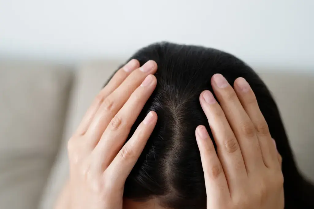 How to Treat an Infected Scalp: Quick Solutions 3 Effective Treatments for Scalp Infection