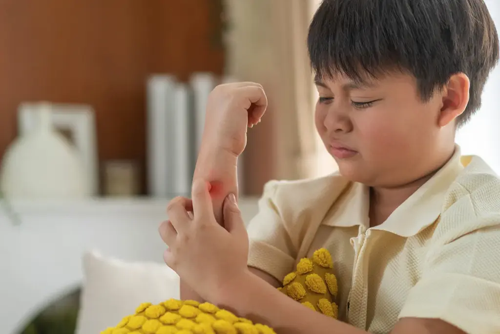 How to Choose the Best Cream for Childhood Eczema