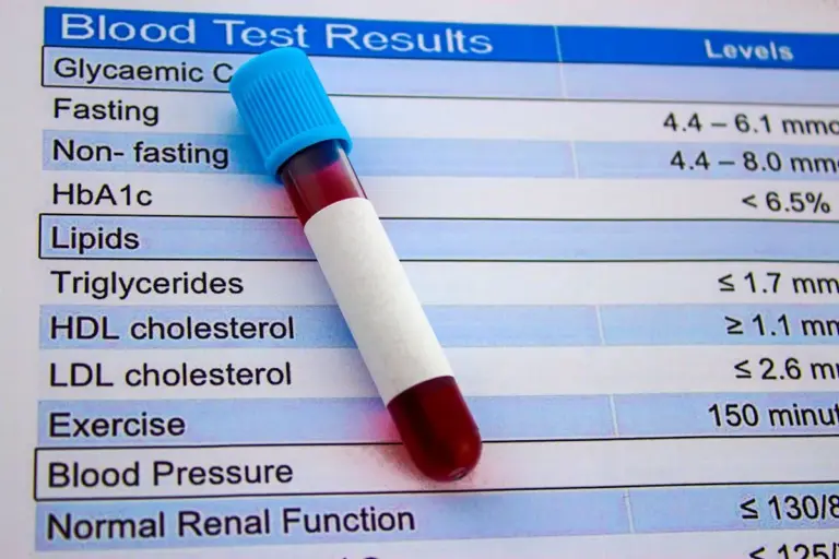 What Does K/UL Mean in Blood Tests and WBC Counts?