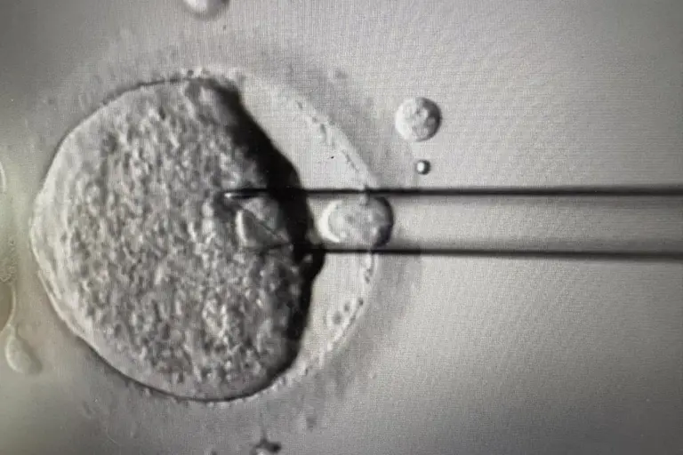 What Does PGS Meaning Stand For and Why Does It Matter?