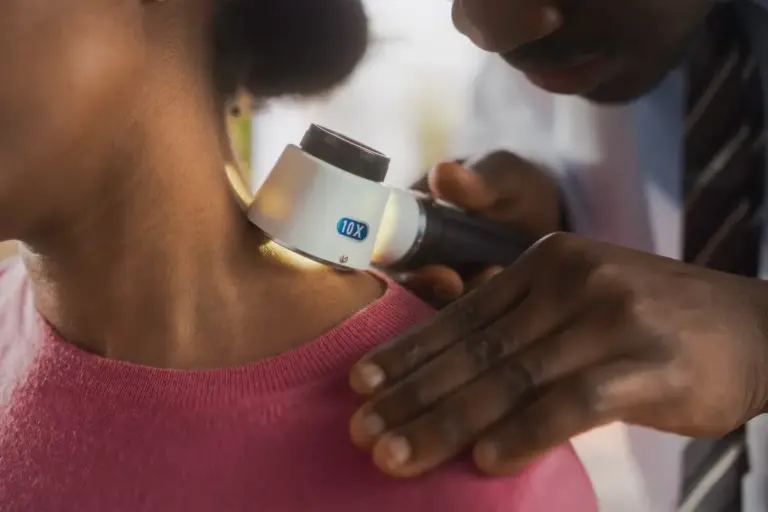 Where Can I Get a Free Sun Cancer Screening Near Me?