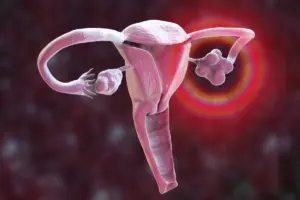 Can an Ovarian Cyst Prevent Pregnancy? What You Need to Know