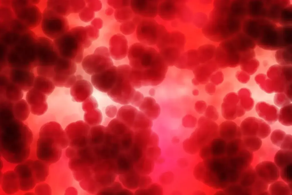 What Is Relative Lymphocytosis and Why Are Your Lymphocytes High? 3 How Relative Lymphocytosis Differs from Absolute Lymphocytosis