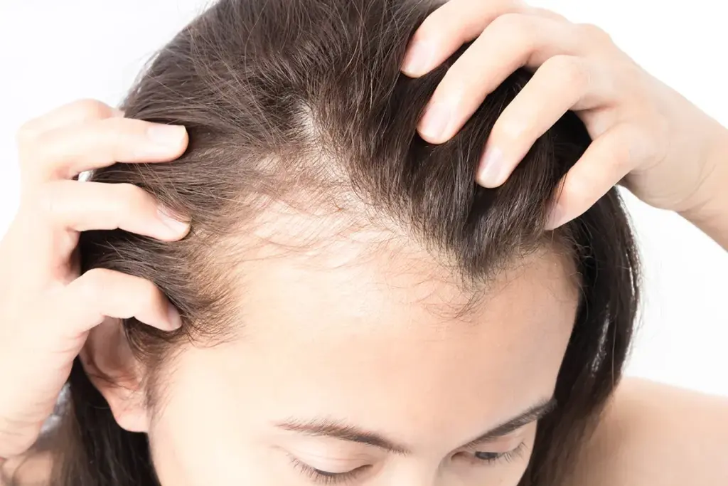 Why Is My Child's Hair Thinning and Falling Out? 3 Why Is My Child's Hair Thinning: Understanding the Patterns
