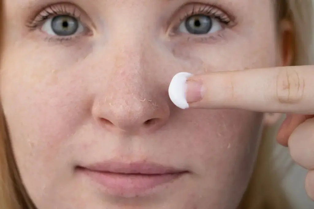 Why Is My Face Dry and Flaky? Causes and Solutions 2 What Causes Flaky Skin on Face: Understanding the Root Issues