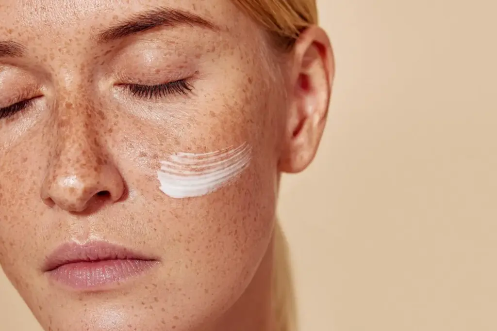 Understanding What Causes Dark Spots on Skin