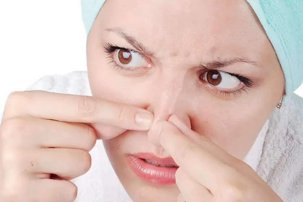 How to Remove Blackheads on Nose: Best Strips & Methods