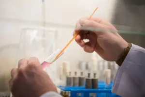 How to Test for Yeast Infection at Home