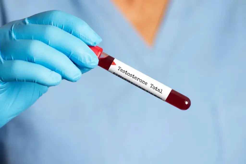 How to Get a Testosterone Blood Test Near You