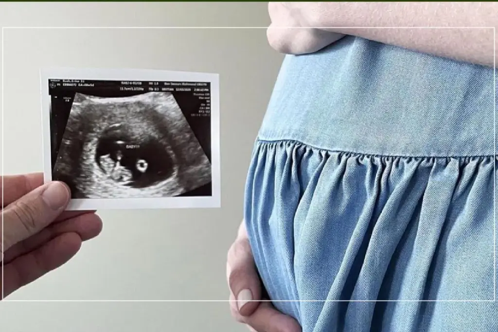 Understanding Miscarriage: Definition and Prevalence