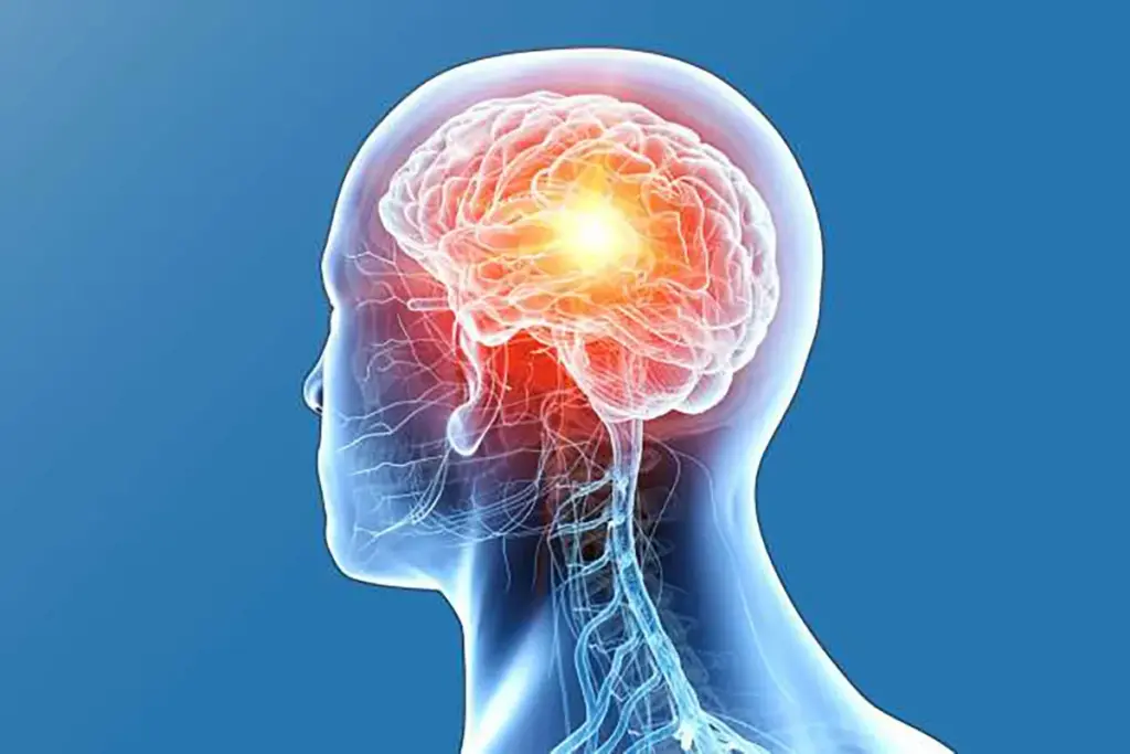 What Is Brain Plaque and What Symptoms Should You Know?