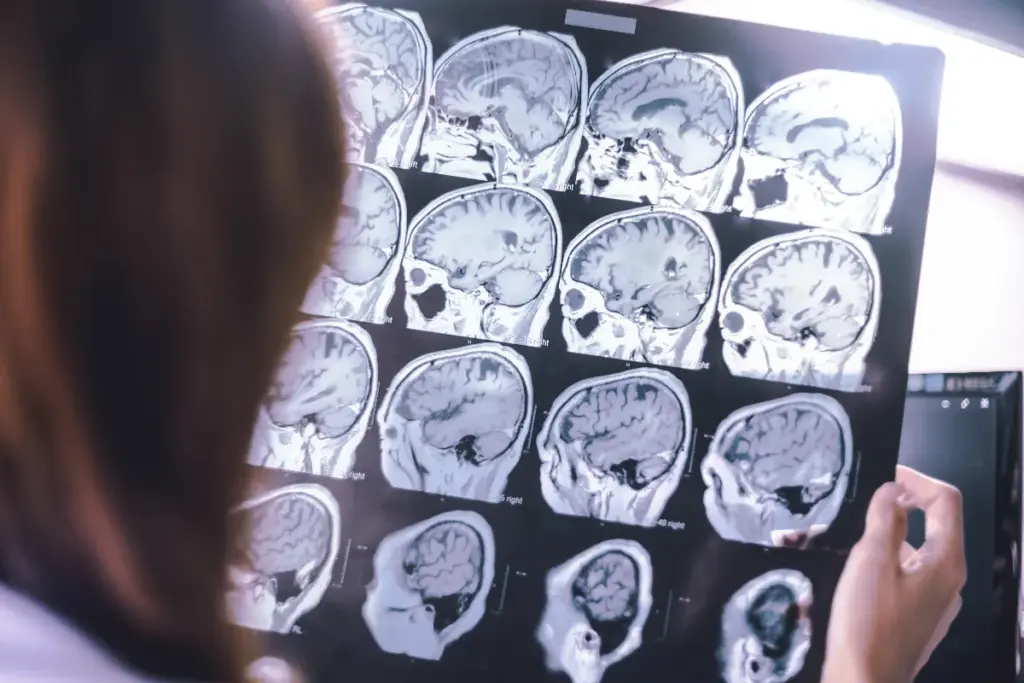 Does Ambien Cause Dementia? Understanding Sleeping Pills and Alzheimer's Risk