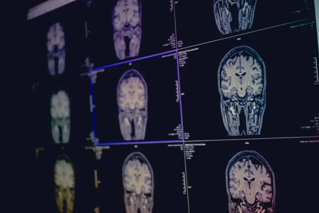 The Link Between Sleeping Pills Dementia and Cognitive Decline