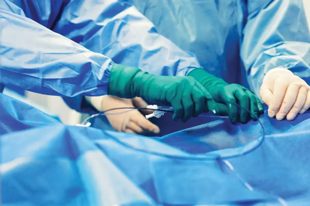 Types of Minimally Invasive Bypass Procedures