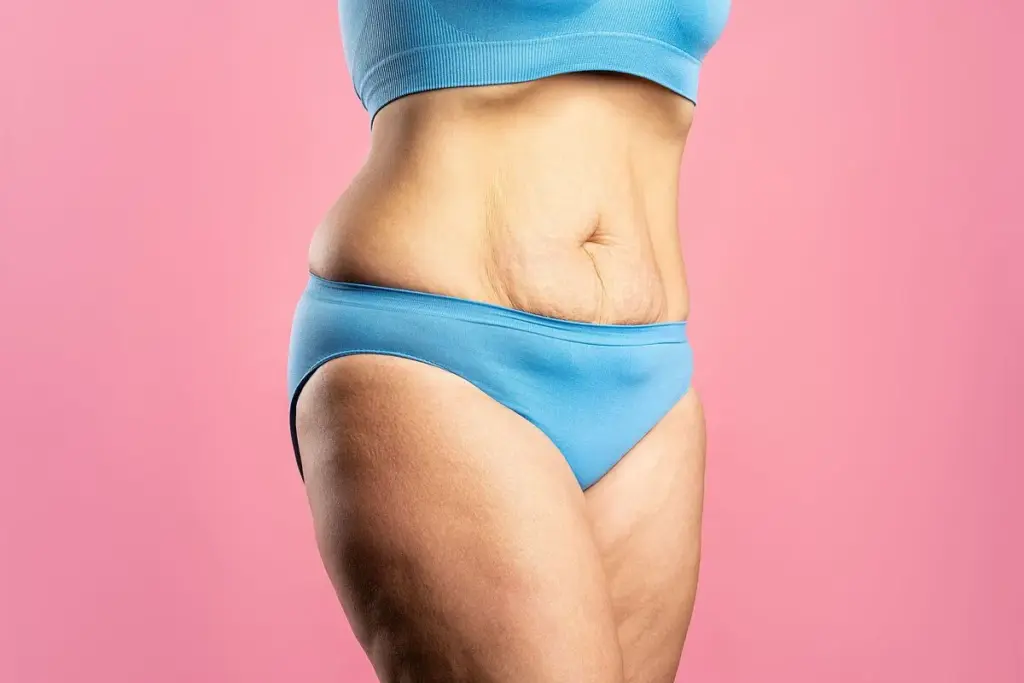Understanding the Science of Skin Elasticity and Weight Loss