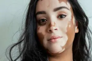 What Does Scar Tissue Lack? Understanding Skin Structure.