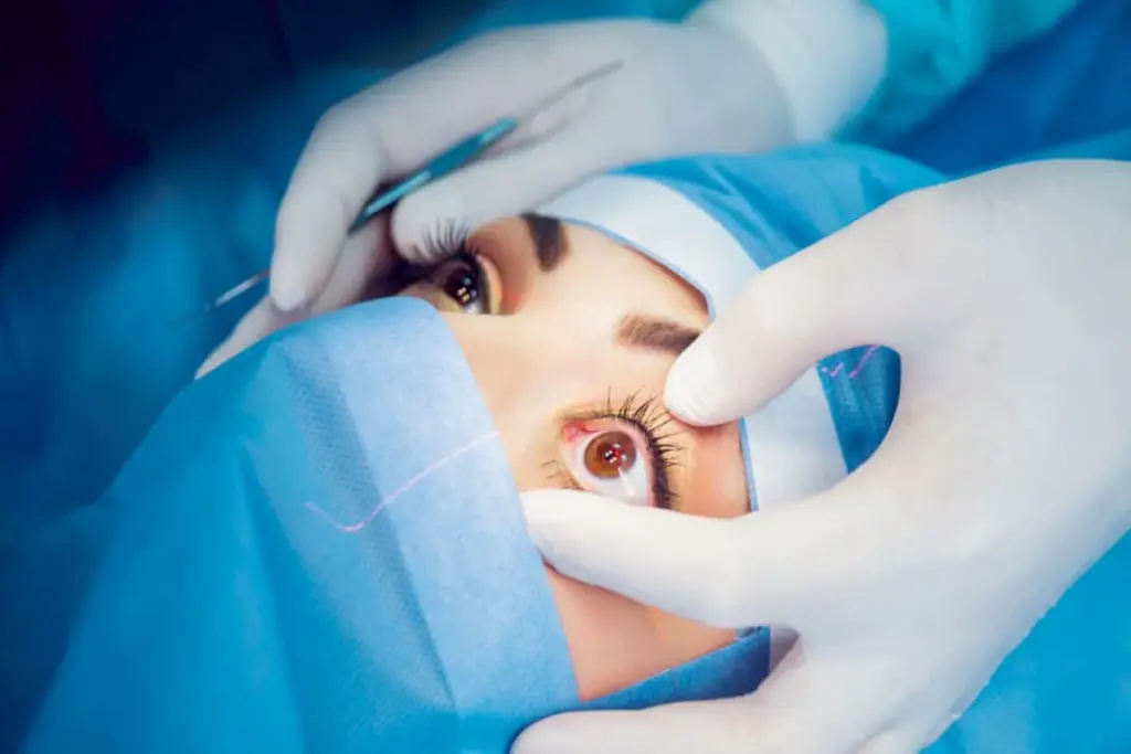 Understanding the Role of Eye Drops After LASIK Surgery